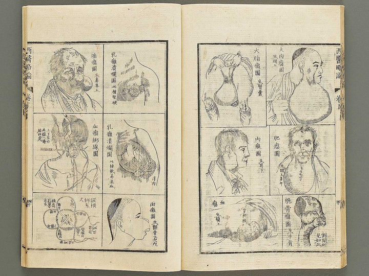 Seii ryakuron (Jo) / BJ326-312