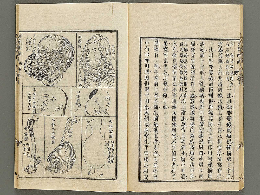 Seii ryakuron (Jo) / BJ326-312