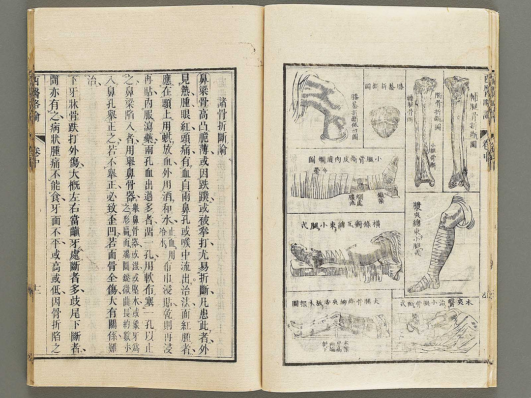 Seii ryakuron (Chu, Jo) / BJ326-319